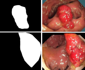 CCIS-Diff