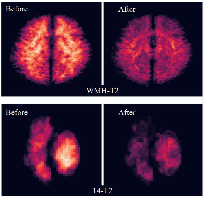 Transfer Risk Map: Mitigating Pixel-level Negative Transfer in Medical Segmentation