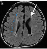 The shcematic MRI image(the healthy region)